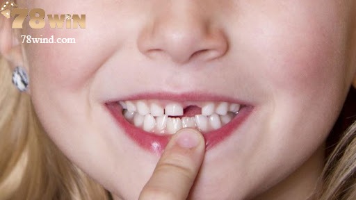 Mỗi trường hợp nằm mơ thấy rụng răng đều mang một điềm báo khác nhau